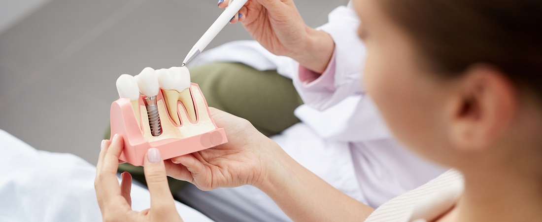 Wszczepienie implantu zębowego to skuteczny sposób na odbudowanie utraconego zęba, warto więc wiedzieć, z jakich produktów można skorzystać. Więcej na blogu.